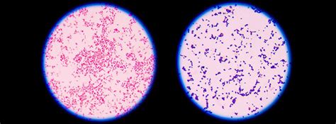 ¿en Qué Consiste La Tinción De Gram Canalsalud
