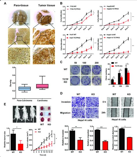 TCTP Is Essential For HCC Progression In Vitro And In Vivo A