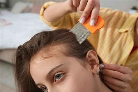 Head Lice Symptoms Causes Diagnosis Licedoctors Licedoctors