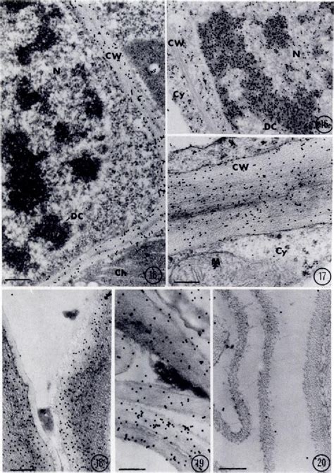 Figure From A New Lectin Gold Complex For Ultrastructural