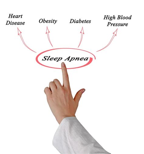 Diagram Of Sleep Apnea Stock Photo By Vaeenma