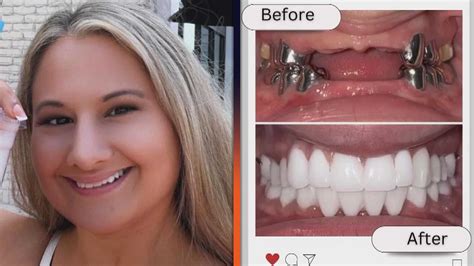 Gypsy Rose Blanchard Reveals Dramatic Teeth Makeover and New Projects