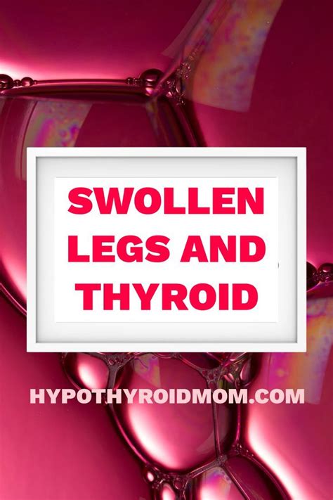 Pin On Popular Thyroid Pins