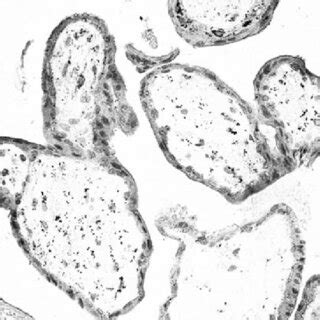 Cytotrophoblast, sincytiotrophoblast and extraembryonic mesenchymal... | Download Scientific Diagram