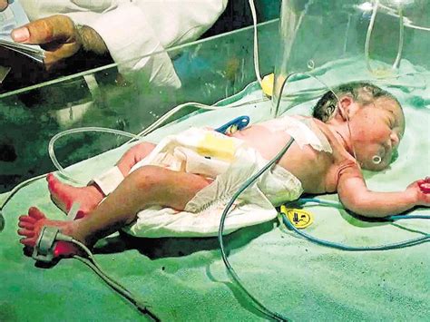 Sex Ratio Improves In Delhi But Infant Mortality Up Latest News Delhi