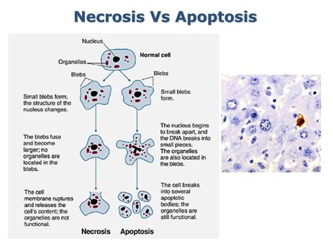 Solution Apoptosis Basic Concepts Cell Biology Studypool