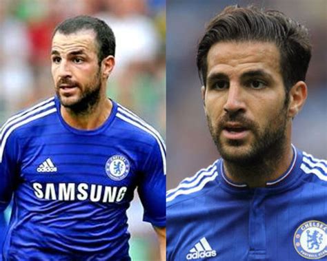 Cesc Fabregas Hair Transplant Journey The Latest News And Updates