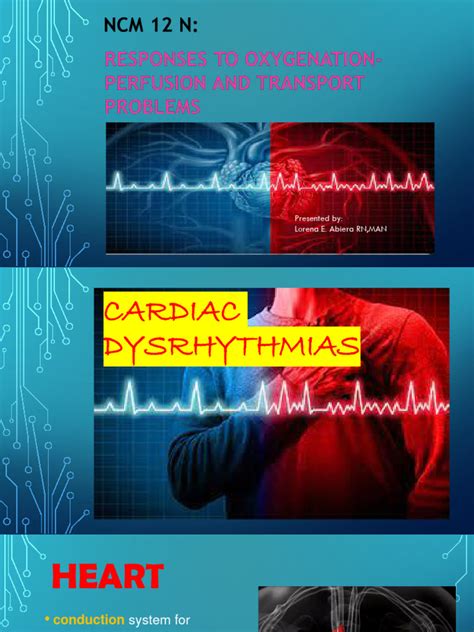 N12 Cardiac Dysrhythmias Pdf Electrocardiography Heart Rate