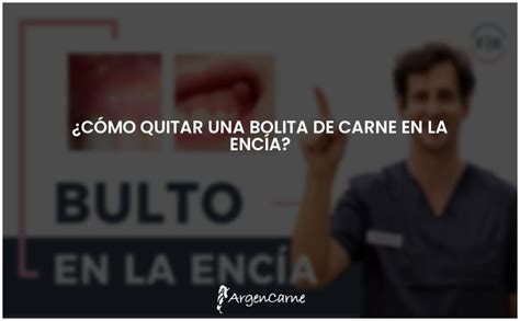 Elimina la bolita de carne en la encía fácilmente ARGENCARNE