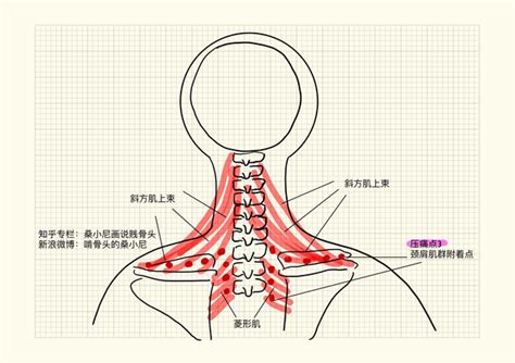 颈椎病自查小贴士 知乎