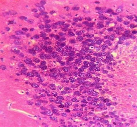 And Fig 4 Show Representative Photomicrograph 40x Of Sections Of