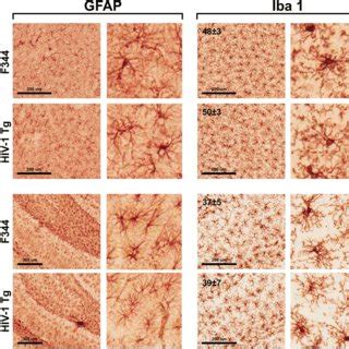 Immunoreactivity For GFAP And Iba 1 Representative Images Of GFAP
