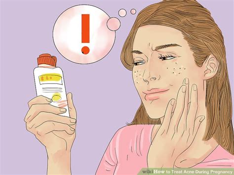 How To Treat Acne During Pregnancy 14 Steps With Pictures