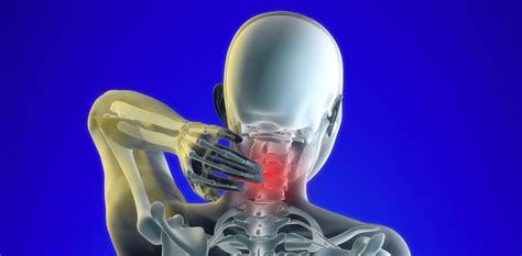 6 Common Causes Of Myofascial Pain And How We Can Best Help