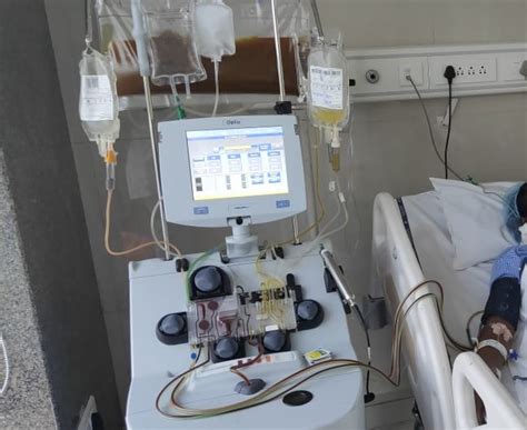 Plasmapheresis Machine