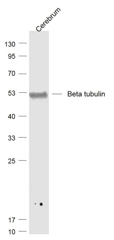 tubulin Beta Rabbit anti Human Polyclonal Bioss 100 μL Unconjugated