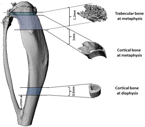 Trabecular And Cortical Bone Regions Analyzed By Microct Trabecular