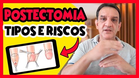 Postectomia Cirurgia De Fimose Conheça Os Procedimentos Da