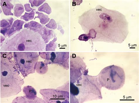 Pdf Infectivity Of Trichomonas Vaginalis Pseudocysts Inoculated Intra Hot Sex Picture