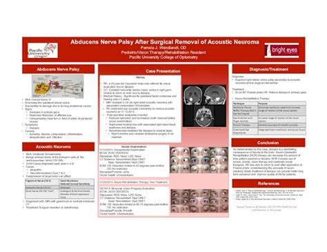 (PDF) Abducens Nerve Palsy After Surgical Removal of Acoustic ... · Abducens Nerve Palsy After ...