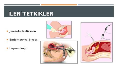 Pelvik Inflamatuar Hastal K Prof Dr Ba Ak Baksu