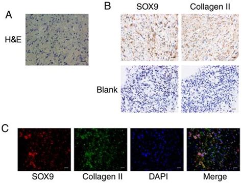 Chondrogenic Differentiation Of Gb Mscs In Micromass Cultured For 21 Download Scientific