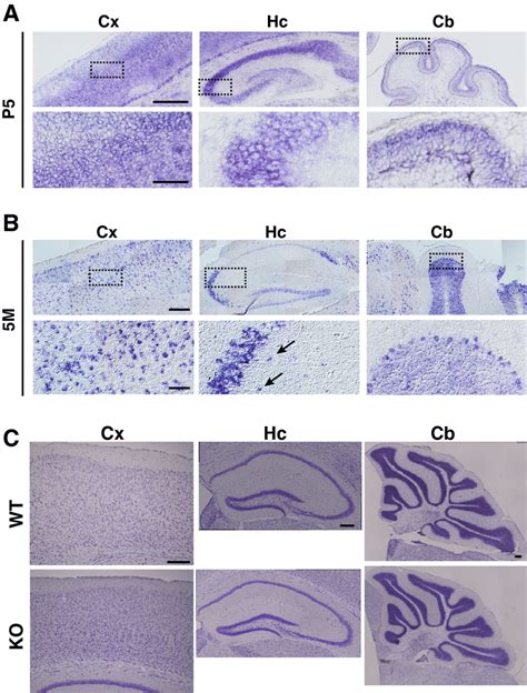 In Situ Hybridization Of LMTK1 MRNA In Mouse Brain And Structures Of