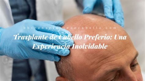 Trasplante De Cabello Preferio Una Experiencia Inolvidable Janellewelch