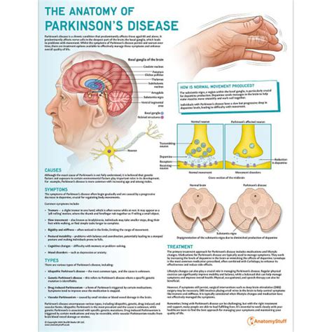 Disease And Disorder Charts Anatomy Charts Anatomystuff