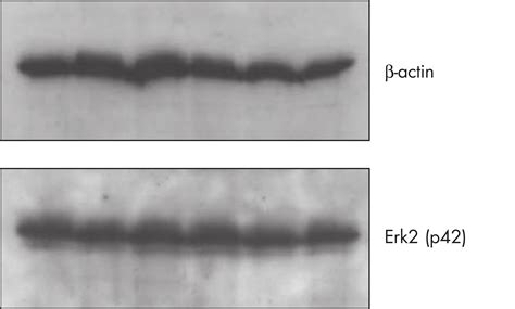 Qproteome Ffpe Tissue Kit Ffpe Protein Extraction Qiagen