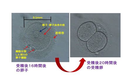 受精卵の発育（翌日） よくあるご質問徐クリニック