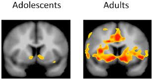 Bryan S Blog Teen Brain Vs Adult Brain