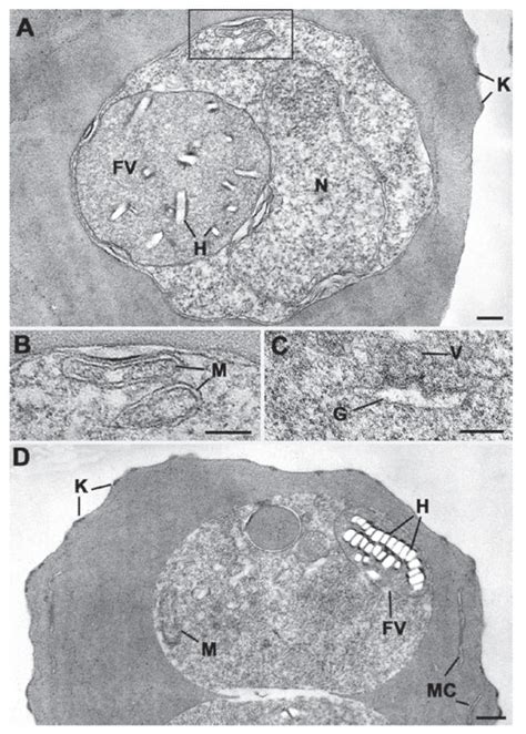 Transmission Electron Micrographs Of The Trophozoite Stage Of