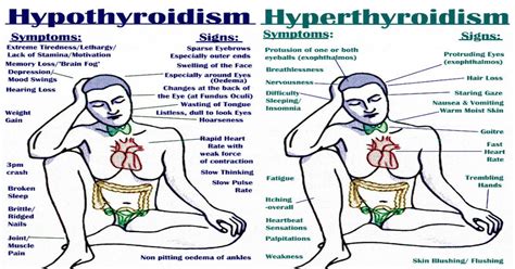 All The Signs Symptoms Triggers And Treatments Of Hypo And