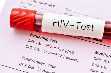 HIV Mobile Testing Van - Long Beach City College