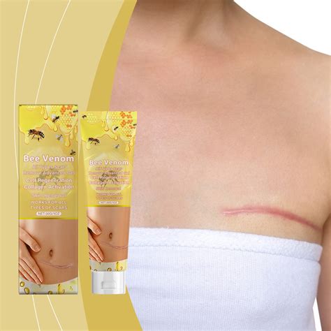 Tongzeng 2packs Personal Skin Careadvanced Scar Gel Old And New The