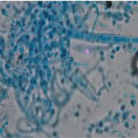 Culture showing Trichophyton rubrum. | Download Scientific Diagram