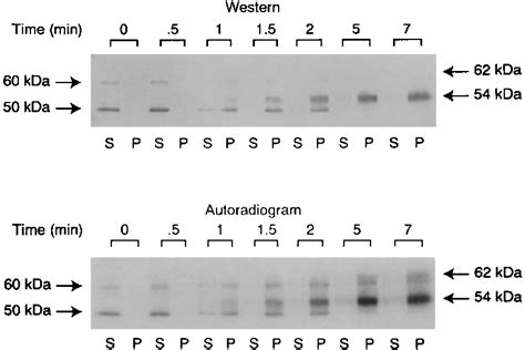 Western Blot And Autoradiogram Showing The Time Course In The Formation