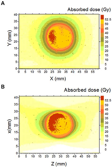 2D Dose Distributions In The 18 Mm Diameter LGK Field A Axial Plane