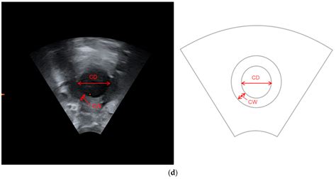 Diagnostics Free Full Text Digital Examination Vs 4d Transperineal Ultrasound—do They