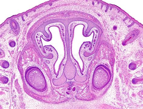 Frontal Section Of Embryoâ€™s Head Stock Image Image Of Palate