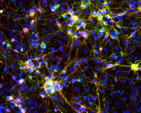 Human Induced Neurons [image] Eurekalert Science News Releases