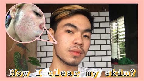 Paano Mawala Ang Pimple Marks Effective Na Rejuvenating Set Ashley