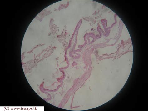 Gall Bladder Histology Labeled