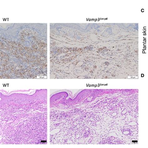 Myeloid Vamp Deletion Reduced Macrophage Infiltration And Inflammation