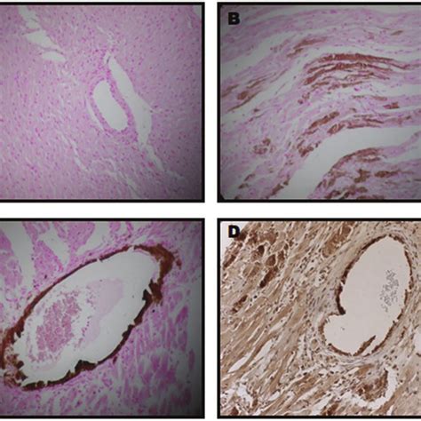 Spearmans Correlation Between Aortic Calcification Measured With The Download Scientific