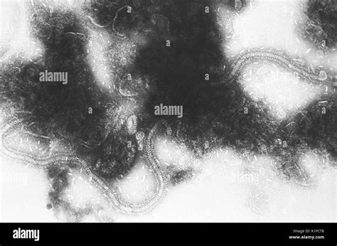 Ce Micrographe Illustre Les Virus Respiratoire Syncytial Vrs Agent