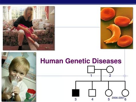 Ppt Human Genetic Diseases Powerpoint Presentation Free Download Id3833119