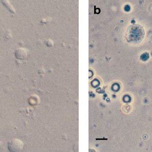 Seven haploid nuclei of round spermatids after aspiration | Download ... 