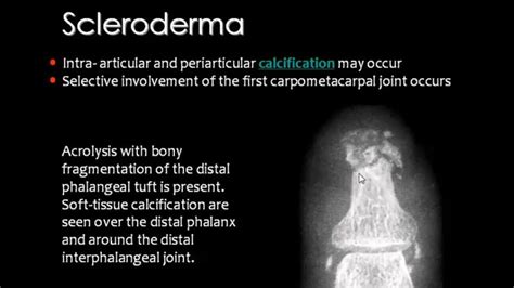 Pin By Aleksandra Stawik On Medyczne Diagnostic Imaging Medical